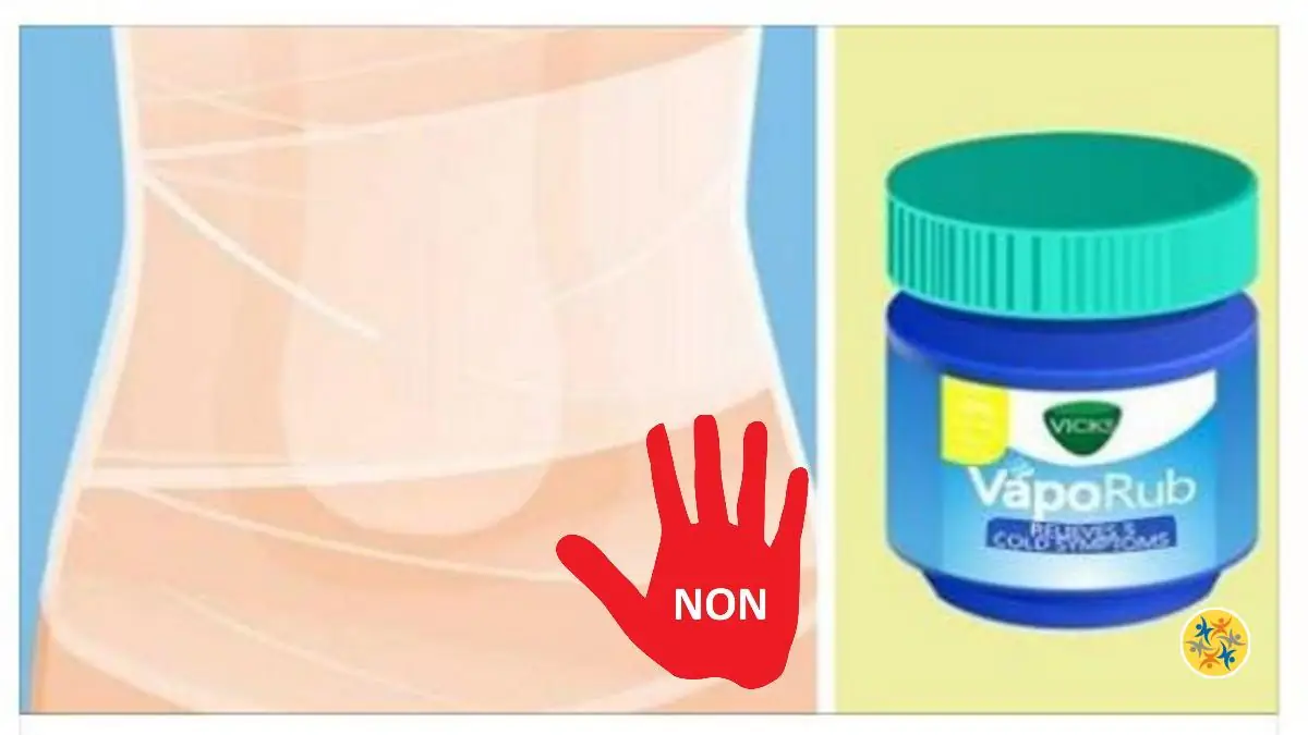Les Bienfaits Du Vicks Sur Le Ventre Evitez ces 6 Utilisations de Vicks Vaporub Pour Prévenir leurs Dangers
