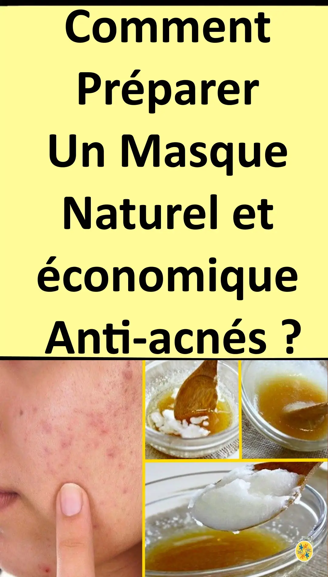 Astuce naturelle pour combattre les boutons  
