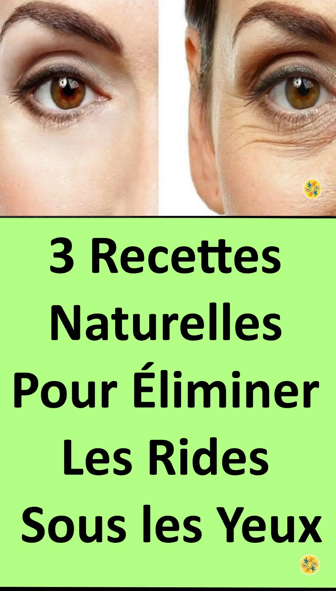 Solutions pour éliminer les rides sous les yeux 
