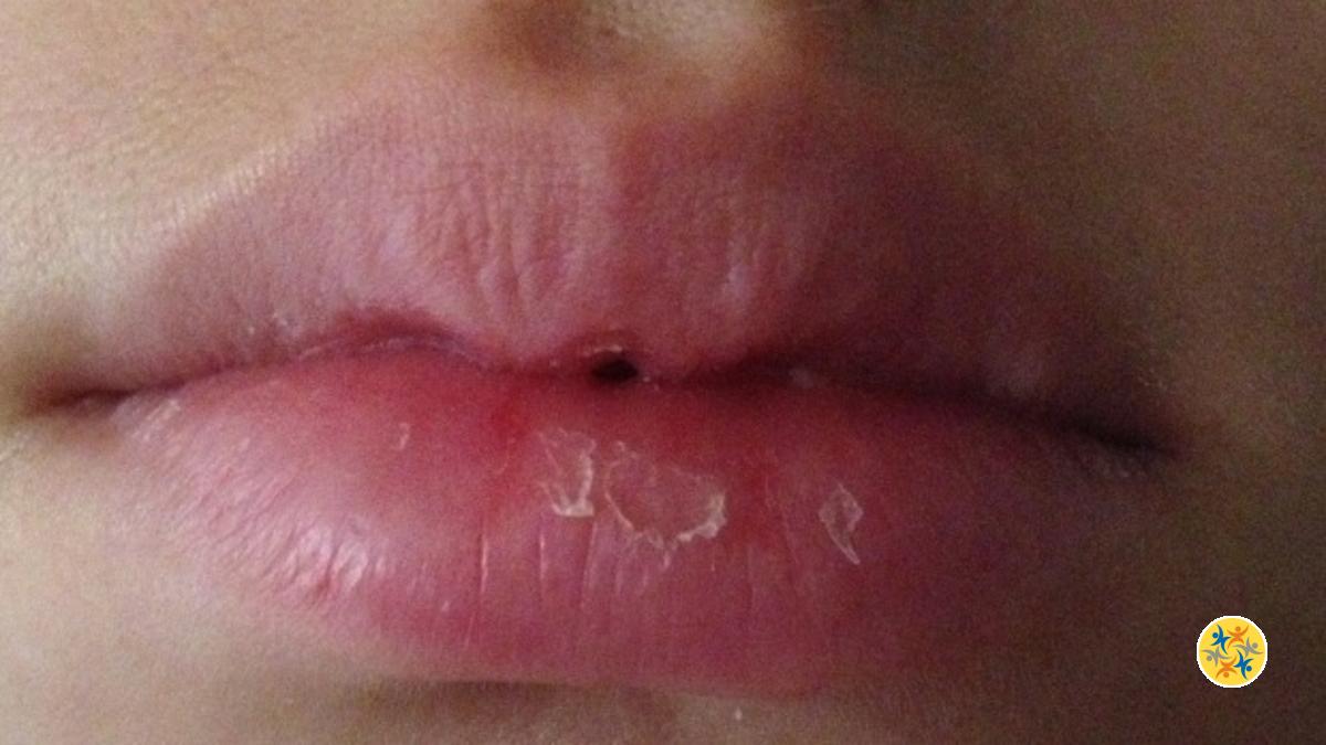 Effet pulpeux des lèvres grâce au Gommage