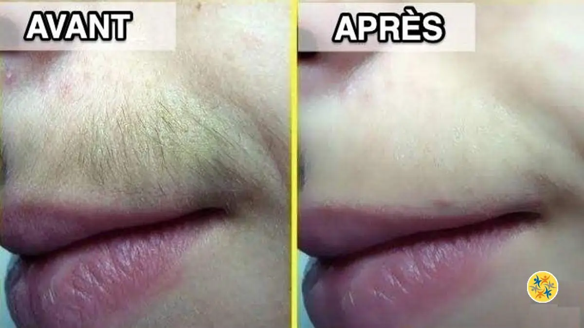 4 Astuces Naturelles pour une Epilation de Visage Réussie et sans Douleur