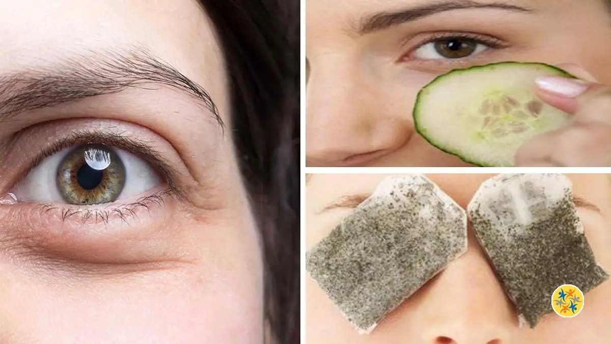 2 Astuces Naturelles pour des Yeux sans Cernes