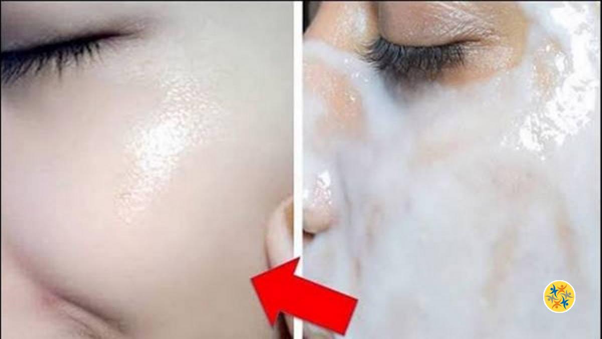 Bicarbonate De Soude Tache Brune Visage Avis Eliminer les Taches Brunes avec 2 Astuces de Bicarbonate de Soude