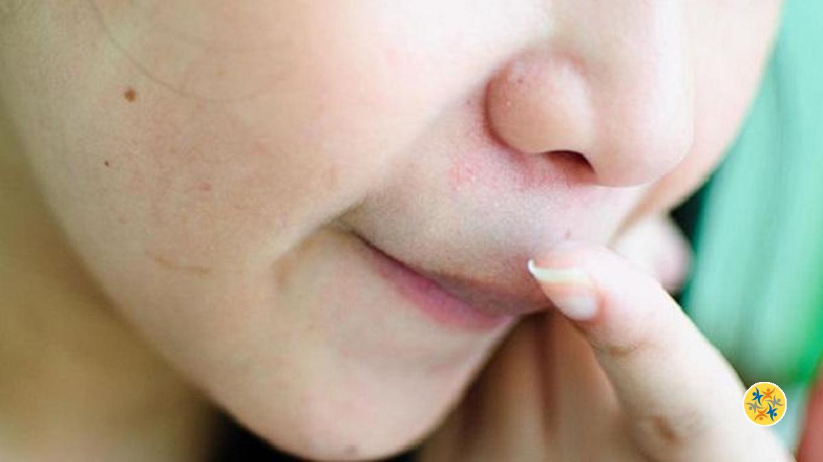 Oubliez les Irritations du Nez avec ces 2 Produits Imprévus