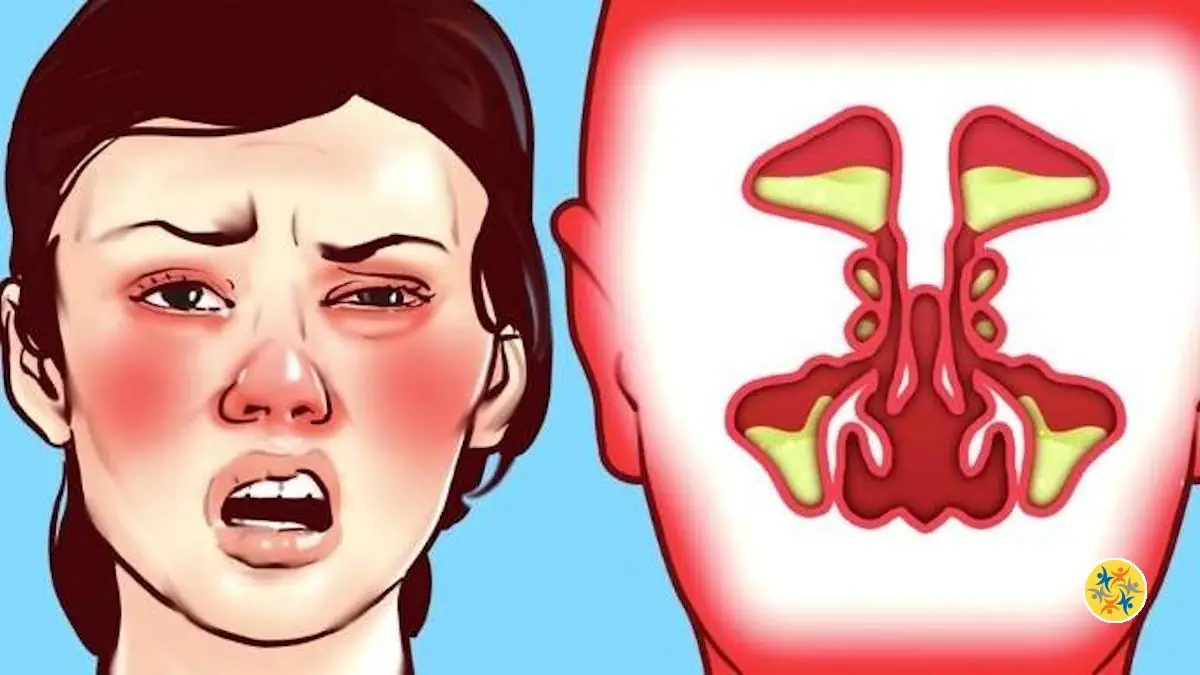 Nez Bouché? 6 Astuces de GrandMère pour une Respiration Instantanée