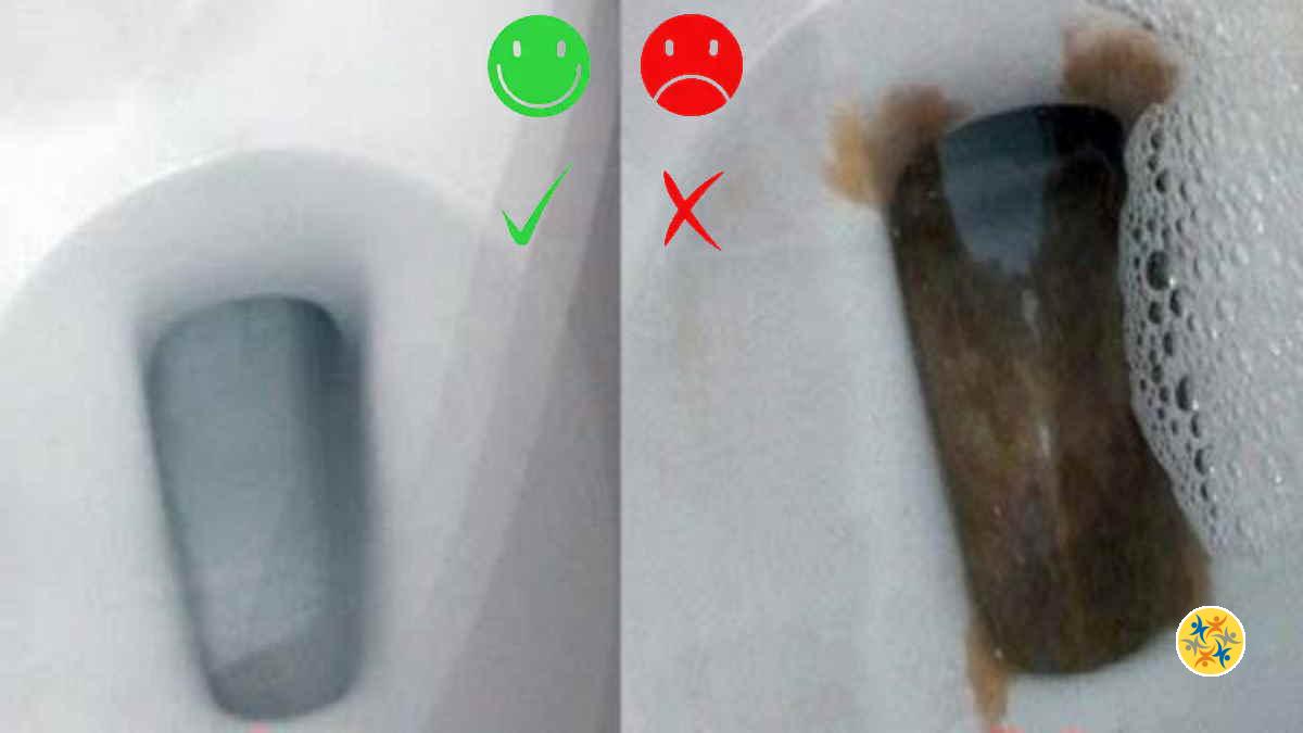 Comment Detartrer Fond Cuvette Wc