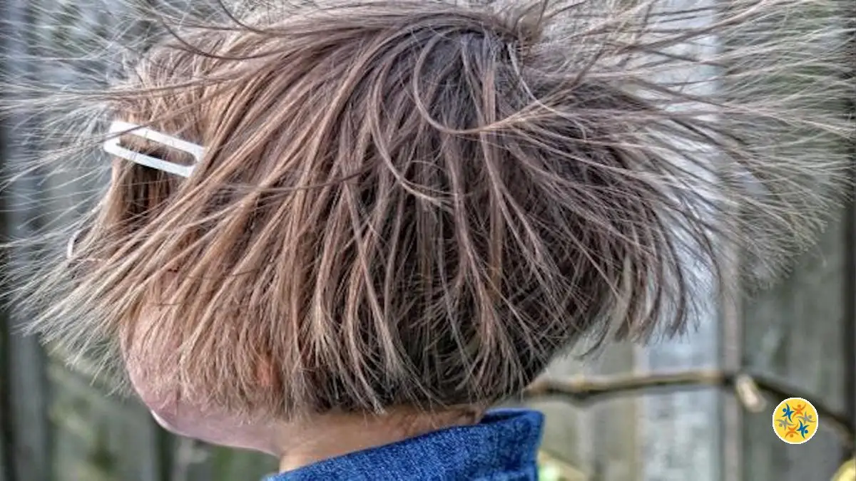 Apprenez à Enlever l’Électricité Statique d’un Vêtement