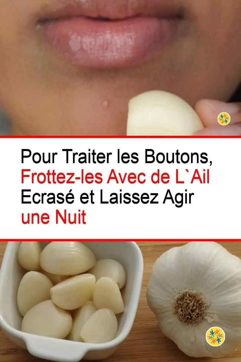 Saviez-vous Que l'Ail Est une Bonne Solution Contre les Boutons ? 12 Soulager les boutons avec l'ail écrasé