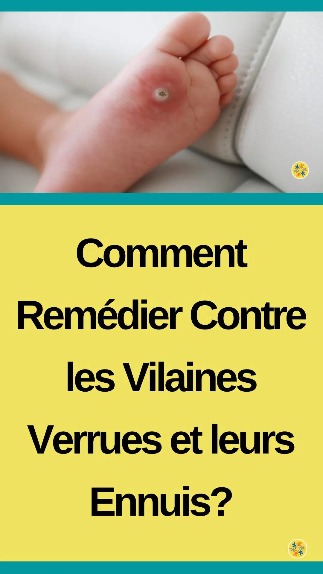 Astuces naturelles pour soulager sa peau 