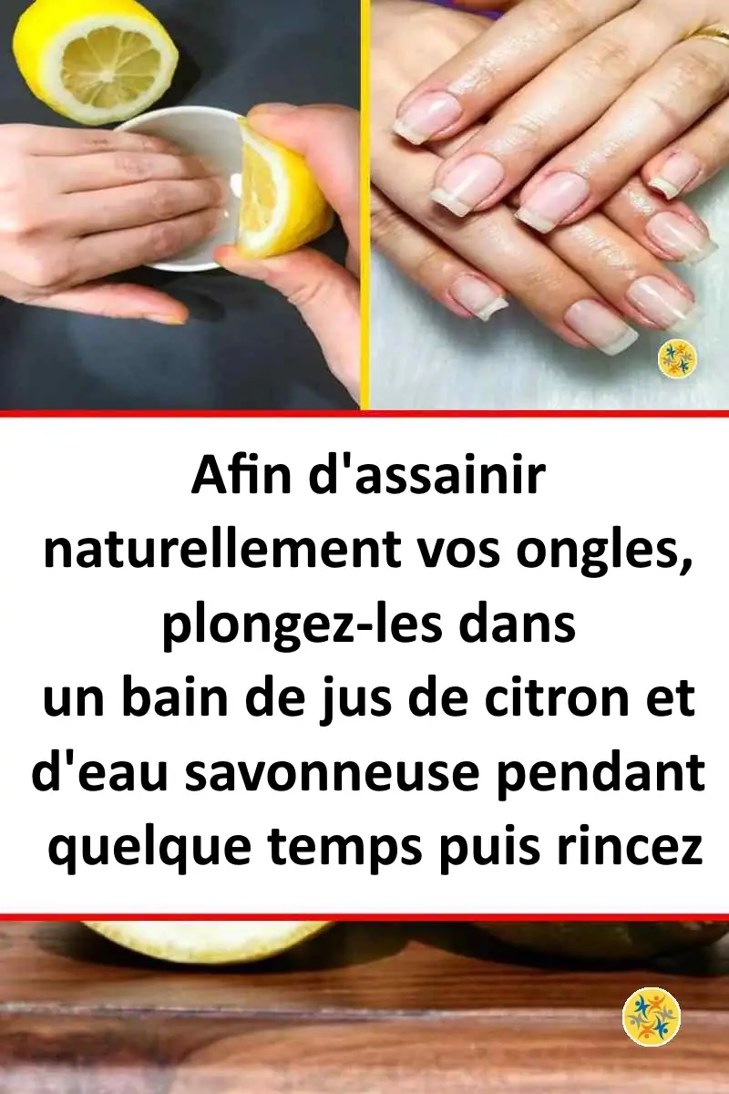 Assainissez vos Ongles en exploitant 3 Remèdes Naturels 18 Astuce du citron pour blanchir et renforcer les ongles